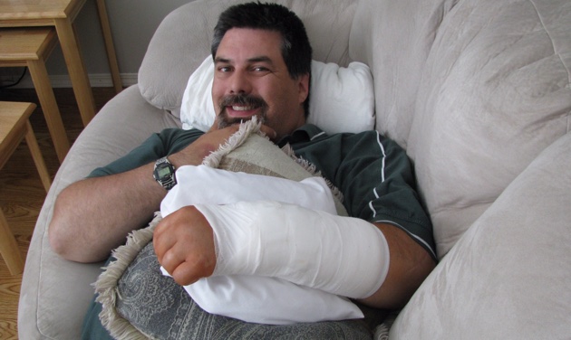 Darren Stolz lays on a couch with his arm in a cast.